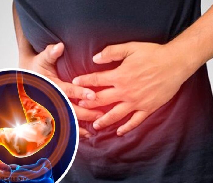 Какво да ям при гастрит 2 Какво да ям при гастрит